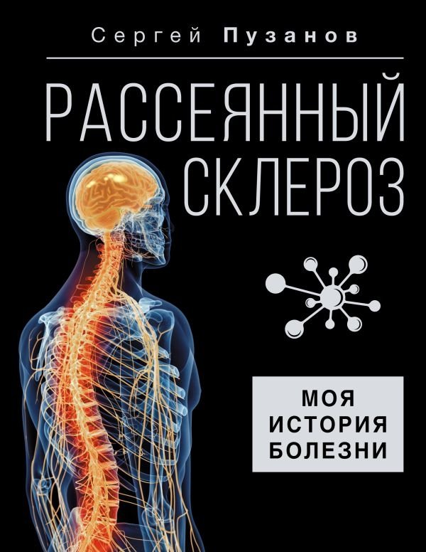 Рассеянный склероз. Моя история болезни | Multiple Sclerosis. My Medical History