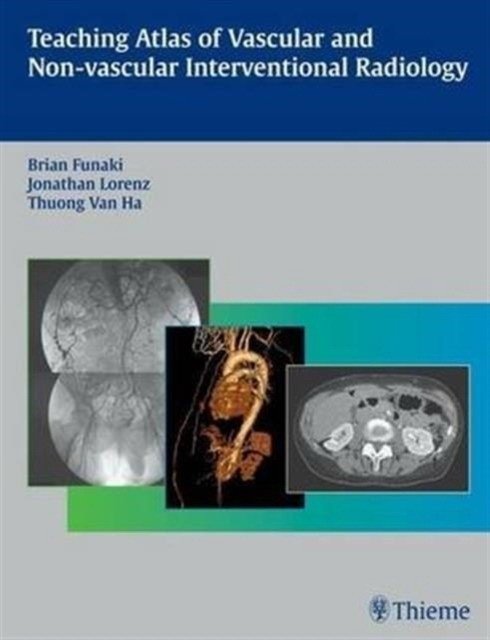 Teaching Atlas of Vascular and Non-vascular Interventional Radiology | Teaching Atlas of Vascular and Non-vascular Interventional Radiology