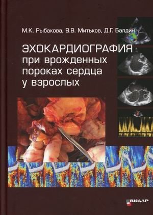 Эхокардиография при врожденных пороках сердца у взрослых | Echocardiography of Congenital Heart Defects in Adults