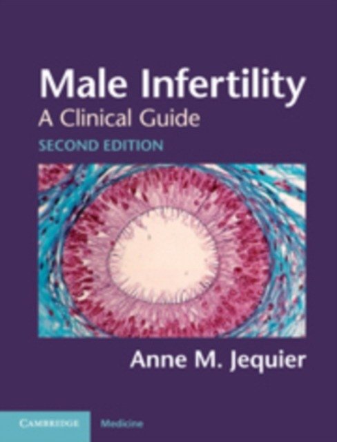 Male Infertility | Male Infertility