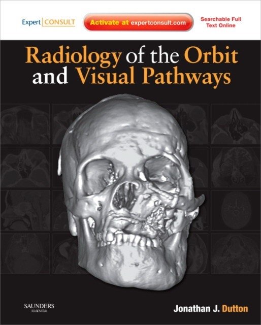 Radiology of the Orbit and Visual Pathways | Radiology of the Orbit and Visual Pathways