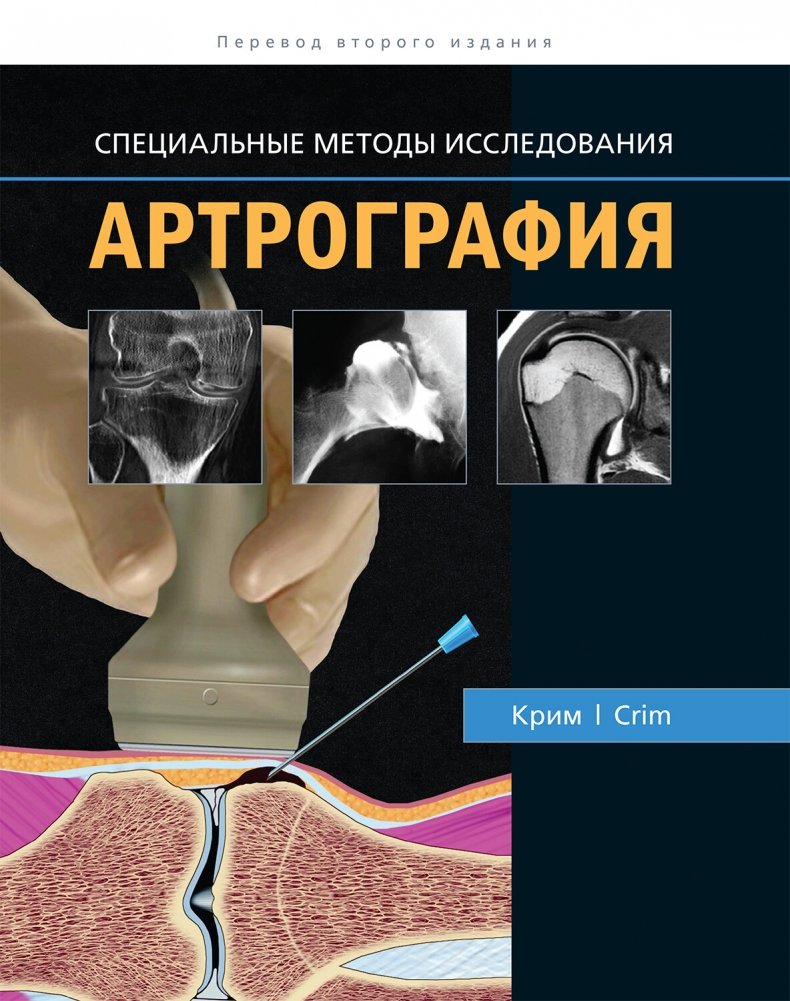 Артрография | Arthrography