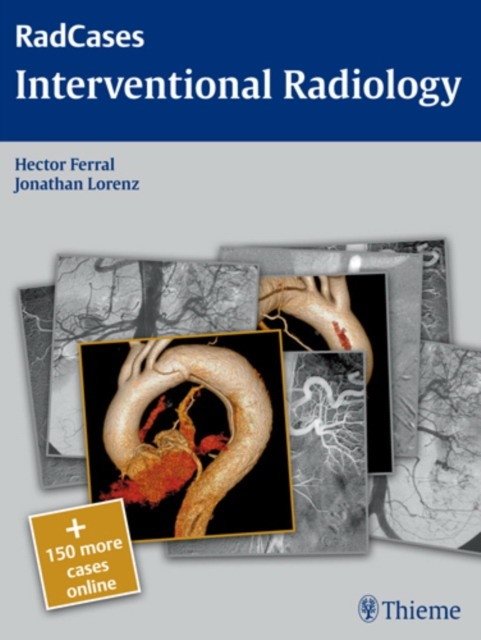 Rad cases: Interventional Radiology | RadCases: Interventional Radiology