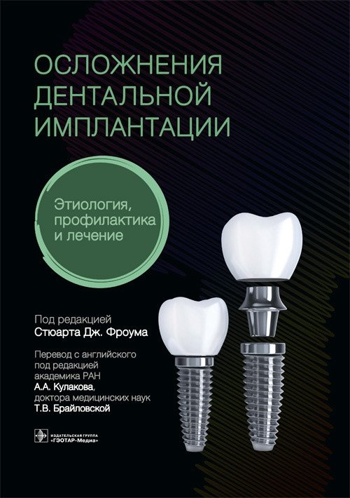 Осложнения дентальной имплантации. Этиология, профилактика и лечение | Complications of Dental Implantation: Etiology, Prevention, and Treatment