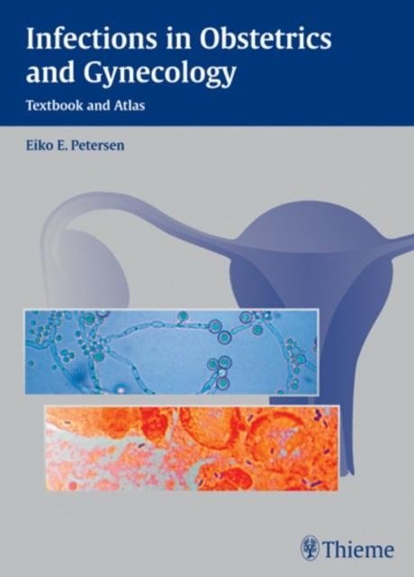 Infections in Obstetrics and Gynecology: Textbook and Atlas | Infections in Obstetrics and Gynecology: Textbook and Atlas