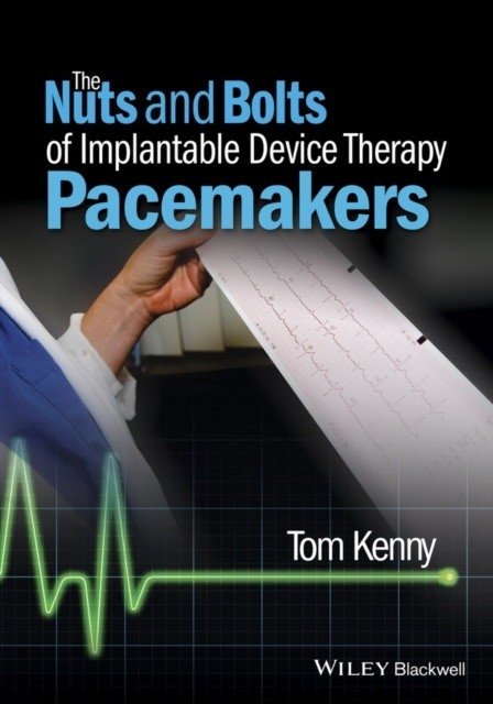 The Nuts and Bolts of Implantable Device Therapy: Pacemakers | The Nuts and Bolts of Implantable Device Therapy: Pacemakers
