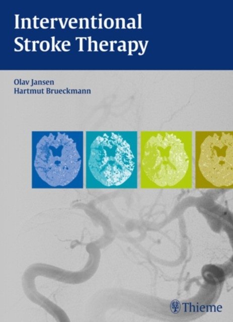 Interventional Stroke Therapy | Interventional Stroke Therapy