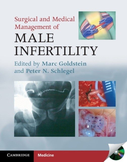 Surgical and Medical Management of Male Infertility | Surgical and Medical Management of Male Infertility