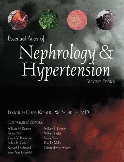 Essential Atlas of Nephrology & Hypertension | Essential Atlas of Nephrology and Hypertension