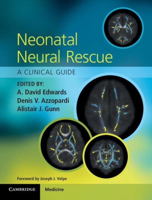 Neonatal Neural Rescue | Neonatal Neural Rescue