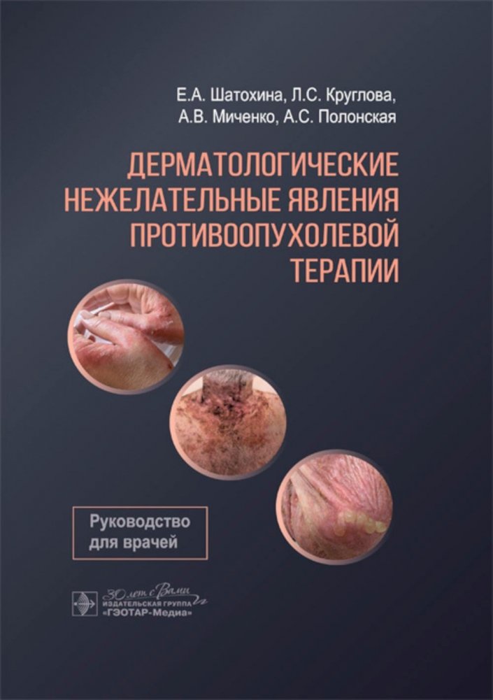Дерматологические нежелательные явления противоопухолевой терапии: руководство для врачей | Dermatological Adverse Events of Antineoplastic Therapy: A Guide for Physicians