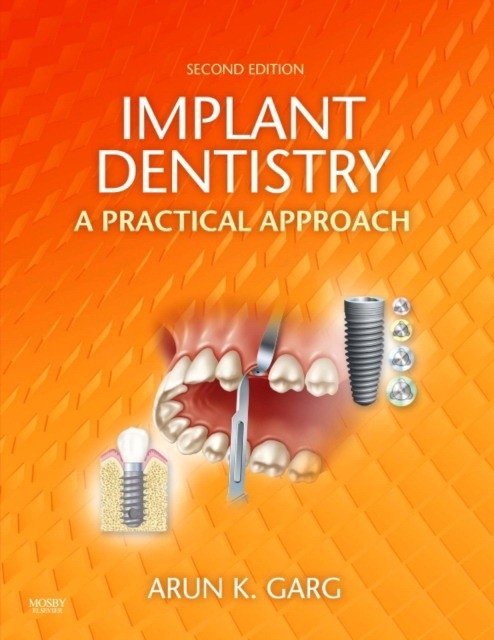 Implant dentistry | Implant Dentistry