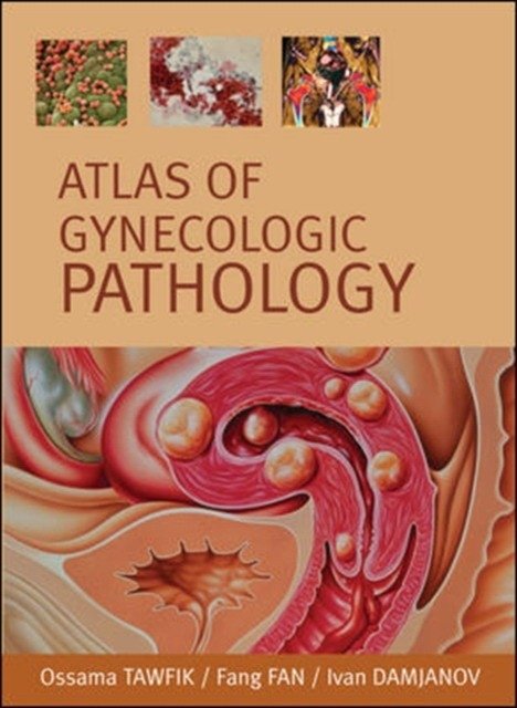 Атлас гинекологической патологии | Atlas of Gynecological Pathology
