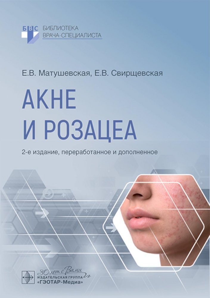 Акне и розацеа. 2-е издание, переработанное и дополненное | Acne and Rosacea: 2nd Edition, Revised and Expanded