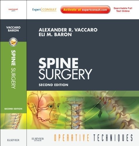 Spine Surgery | Spine Surgery