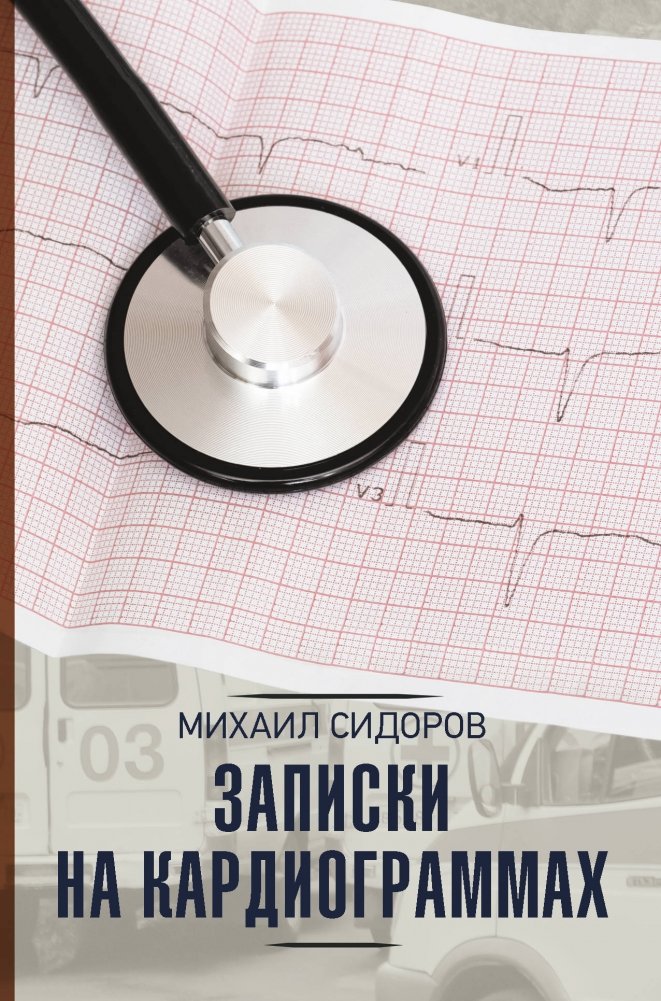 Записки на кардиограммах | Notes on Cardiograms