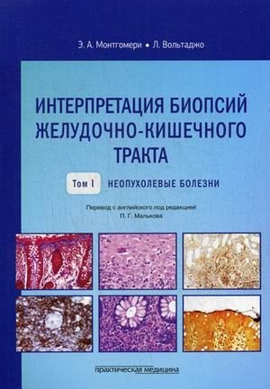 Интерпретация биопсий желудочно-кишечного тракта. Руководство. Том 1: Неопухолевые болезни | Interpretation of Gastrointestinal Biopsies: A Guide, Volume 1: Non-Neoplastic Diseases
