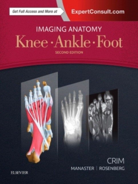 Imaging Anatomy: Knee, Ankle, Foot | Imaging Anatomy: Knee, Ankle, Foot