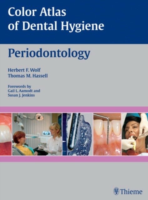 Color Atlas of Dental Hygiene: Periodontology | Color Atlas of Dental Hygiene: Periodontology