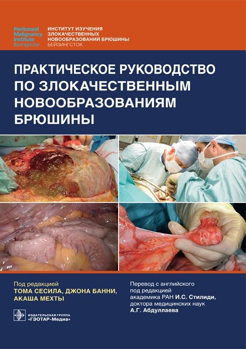 Практическое руководство по злокачественным новообразованиям брюшины | Practical Guide to Malignant Peritoneal Neoplasms