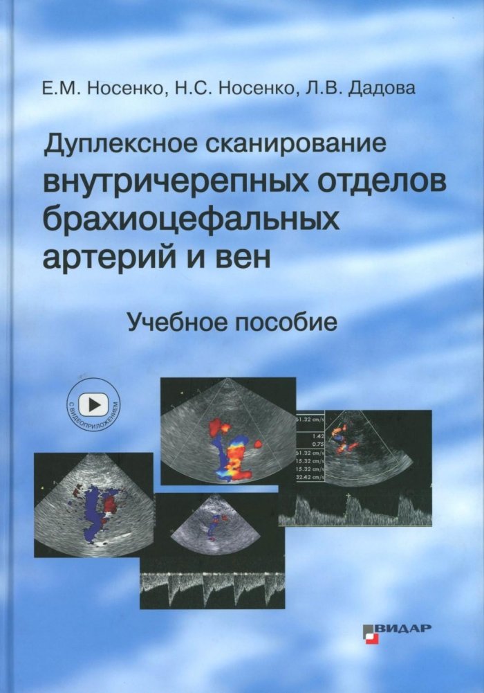 Дуплексное сканирование внутричерепных отделов брахиоцефальных артерий и вен. Учебное пособие | Duplex Scanning of Intracranial Segments of Brachiocephalic Arteries and Veins: A Study Guide