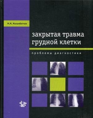 Закрытая травма грудной клетки. Проблемы диагностики | Closed Chest Trauma: Diagnostic Challenges