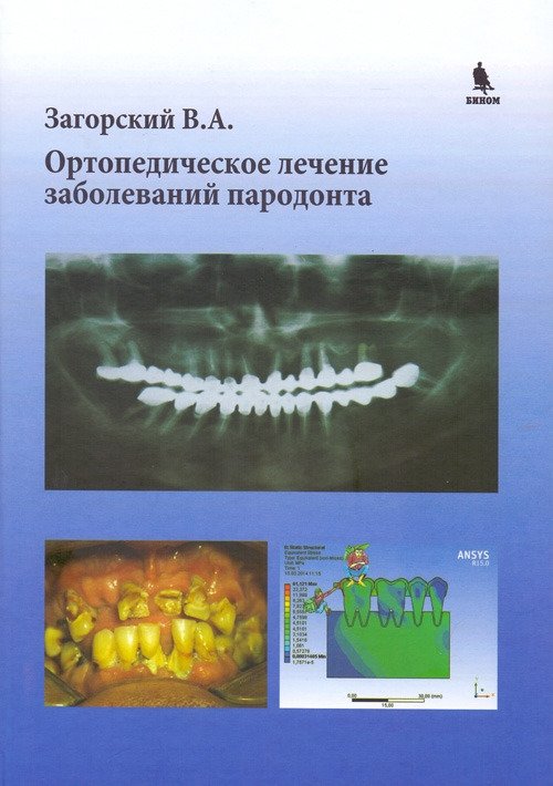 Ортопедическое лечение заболеваний пародонта | Orthopedic Treatment of Periodontal Diseases