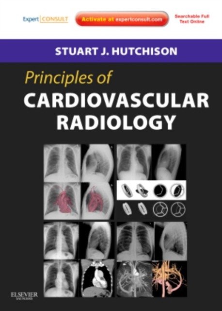 Principles of Cardiovascular Radiology | Principles of Cardiovascular Radiology