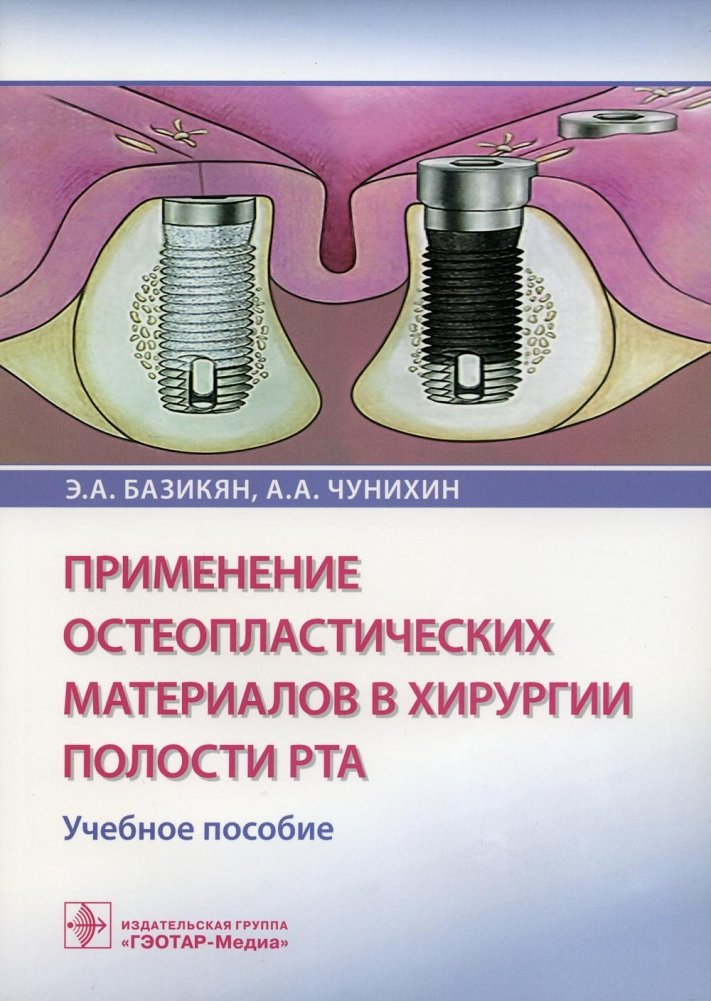 Применение остеопластических материалов в хирургии полости рта. Учебное пособие | Application of Osteoplastic Materials in Oral Surgery: A Textbook