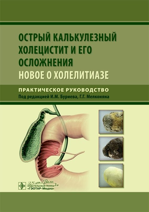 Острый калькулезный холецистит и его осложнения. Новое о холелитиазе | Acute Calculous Cholecystitis and Its Complications: New Insights into Cholelithiasis