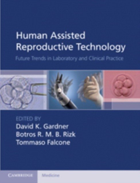 Human Assisted Reproductive Technology | Human Assisted Reproductive Technology