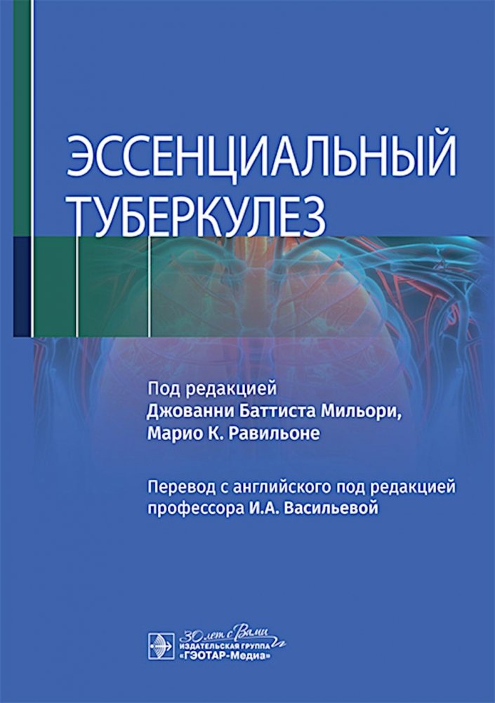 Эссенциальный туберкулез | Essential Tuberculosis