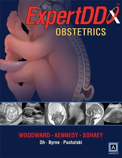 Expert Differential Diagnoses: Obstetrics | Expert Differential Diagnoses: Obstetrics