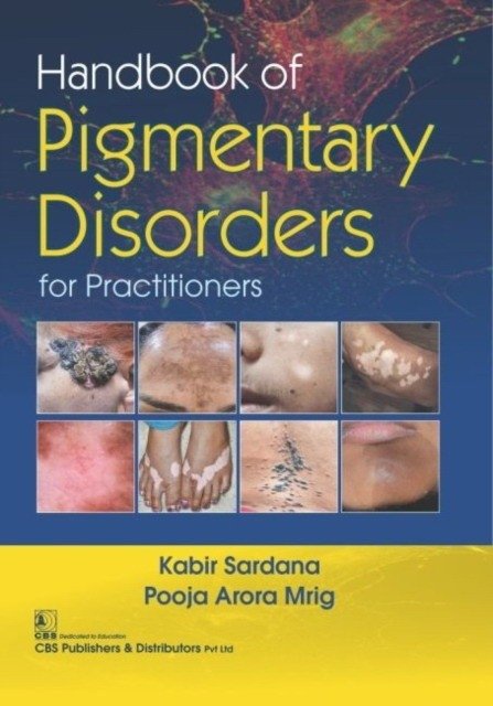 Handbook Of Pigmentary Disorders For Practitioners (Hb 2019) | Handbook of Pigmentary Disorders for Practitioners