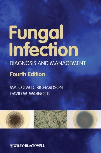 Fungal Infection: Diagnosis and Management, 4th Edition | Fungal Infection: Diagnosis and Management, 4th Edition