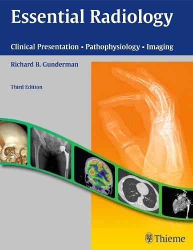 Essential Radiology: Clinical Presentation. Pathophysiology. Imaging | Essential Radiology: Clinical Presentation, Pathophysiology, Imaging