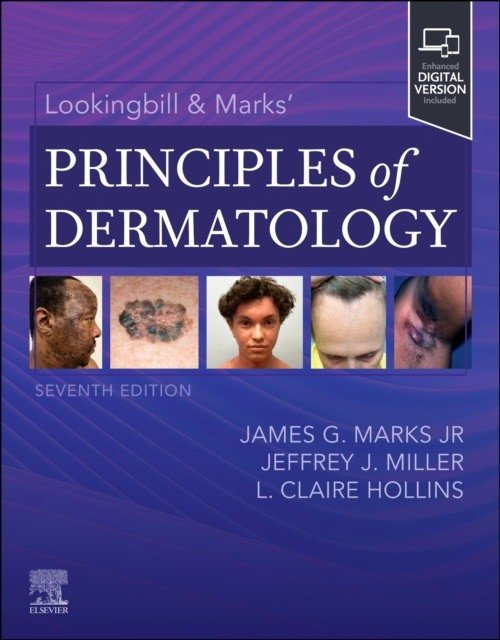 Lookingbill & Marks’ Principles of Dermatology | Lookingbill & Marks' Principles of Dermatology
