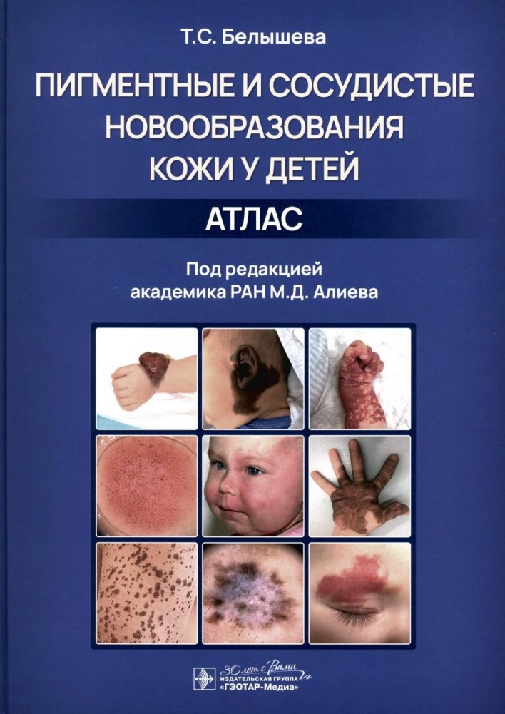 Пигментные и сосудистые новообразования кожи у детей. Атлас | Pigmented and Vascular Skin Neoplasms in Children: An Atlas