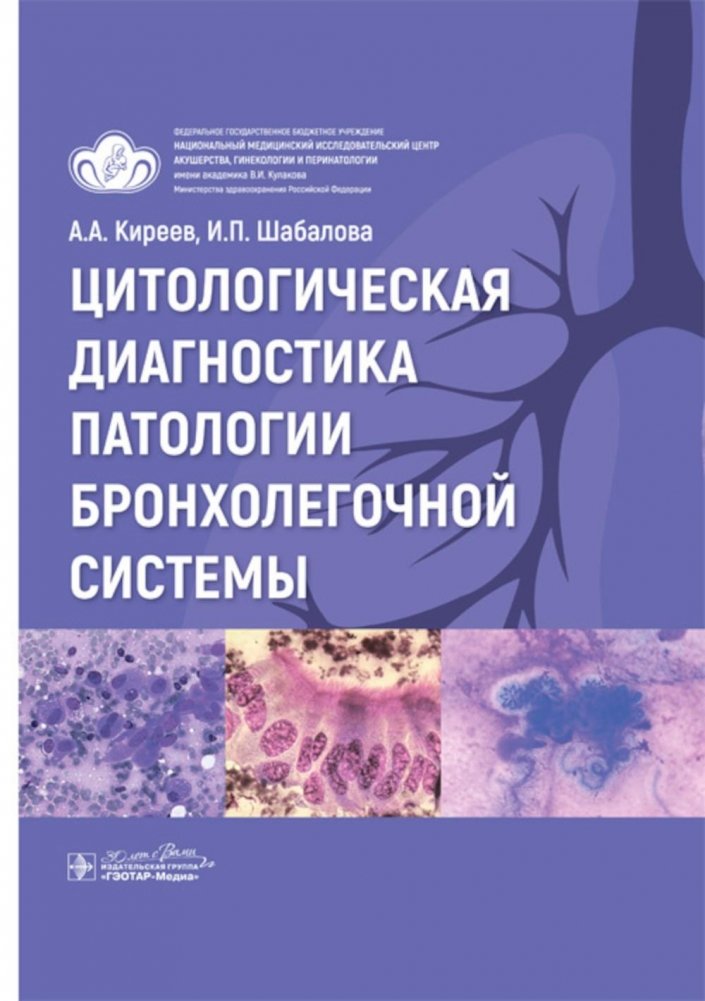 Цитологическая диагностика патологии бронхолегочной системы | Cytological Diagnosis of Bronchopulmonary System Pathology