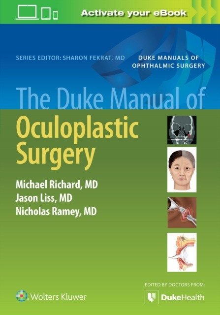 Duke Manual Oculoplastic Surgery | Duke Manual of Oculoplastic Surgery