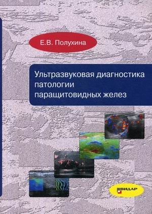 Ультразвуковая диагностика патологии паращитовидных желез. Руководство | Ultrasound Diagnostics of Parathyroid Gland Pathology: A Guide
