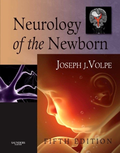 Неврология новорожденных | Neurology of the Newborn