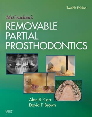 McCracken's Removable Partial Prosthodontics | McCracken's Removable Partial Prosthodontics