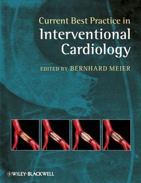 Current Best Practice in Interventional Cardiology | Current Best Practice in Interventional Cardiology