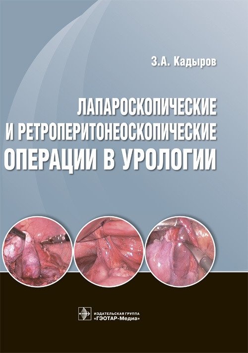 Лапароскопические и ретроперитонеоскопические операции в урологии | Laparoscopic and Retroperitoneal Operations in Urology