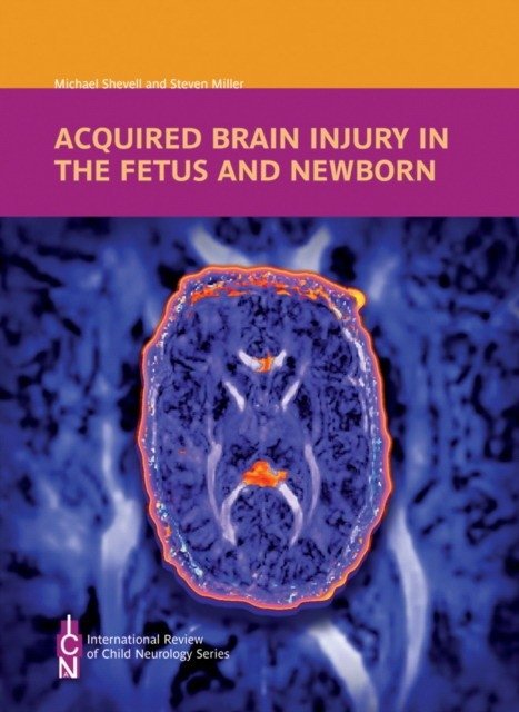 Acquired Brain Injury in the Fetus and Newborn | Acquired Brain Injury in the Fetus and Newborn
