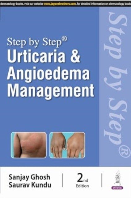Step By Step Urticaria And Angioedema Management, 2/e | Step-by-Step Urticaria and Angioedema Management, 2nd Edition