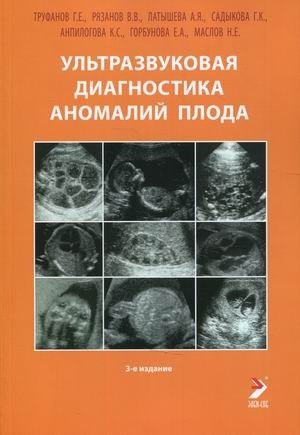 Ультразвуковая диагностика аномалий плода. Руководство для врачей | Ultrasound Diagnosis of Fetal Anomalies: A Guide for Physicians
