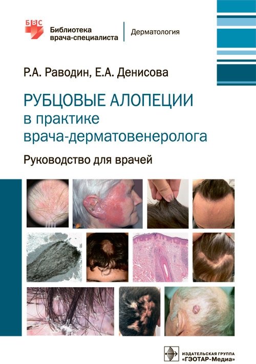 Рубцовые алопеции в практике врача-дерматовенеролога | Scarring Alopecia in Dermatovenereology Practice