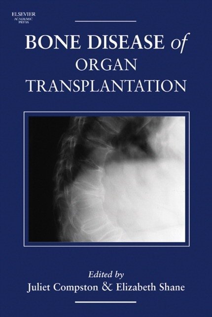 Bone Disease of Organ Transplantation | Bone Disease in Organ Transplantation